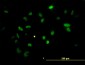 CHEK2 Antibody (monoclonal) (M01)
